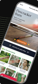 Burn First Aid mobile interface